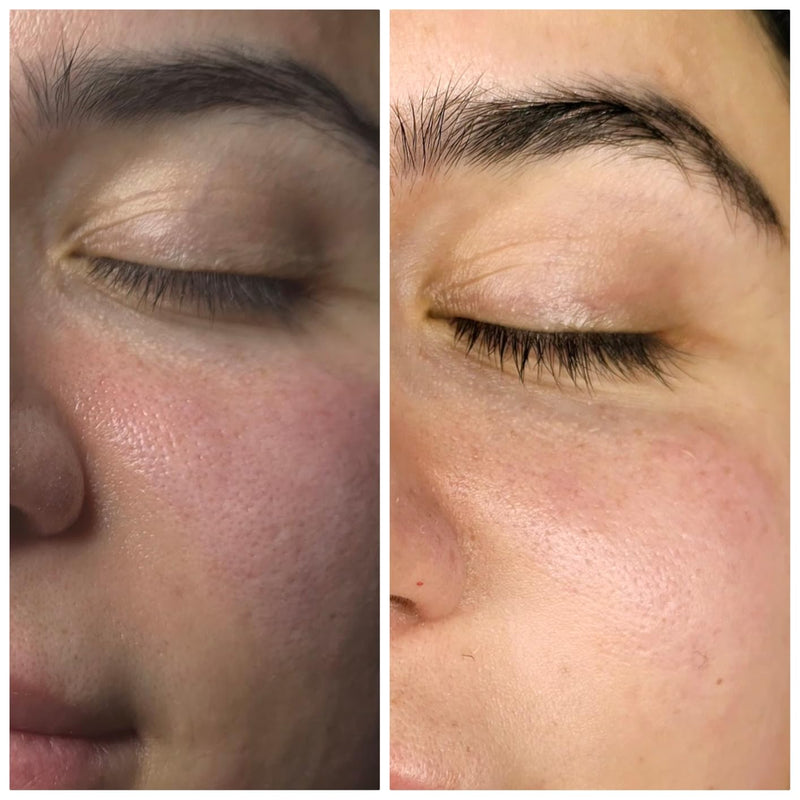 Rachel D. before and after