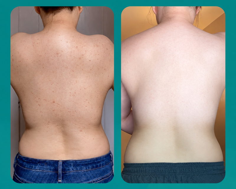 Rachel D. before and after